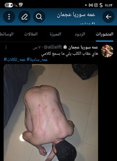 مستريس عمه - adult performer in Ajmān Photo 1 of 4