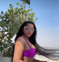 African Candy +91//813293//3962 - escort in Bangalore