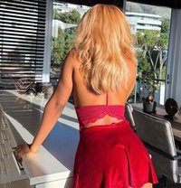 African Remmy +91//990416//5832 - escort in Ahmedabad