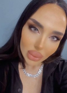 Anuella - puta in Yerevan Photo 3 of 8