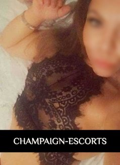 Champaign Escorts - escort agency in Leeds Photo 3 of 4