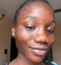 Chole - escort in Lagos, Nigeria Photo 1 of 4
