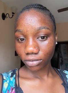 Chole - escort in Lagos, Nigeria Photo 3 of 4