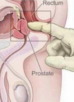 Professional Prostate Massage - escort in Al Manama Photo 3 of 6