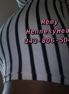 Remy HennesyHeat - puta in Ottawa Photo 3 of 5