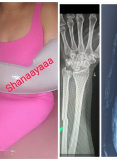 Shanaayaaa Indep Soft GFE No Advance - escort in Bangalore Photo 7 of 7