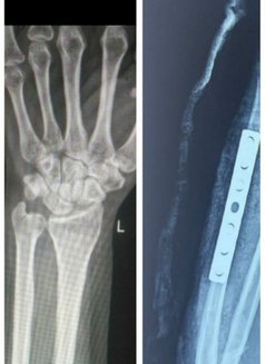 Shanaayaaa Indep Soft GFE No Advance - puta in Bangalore Photo 9 of 11