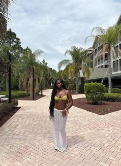 Sugar Baby - escort in Abidjan Photo 2 of 3